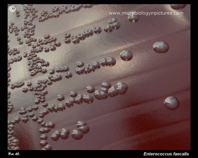 E.faecalis colonies on blood agar